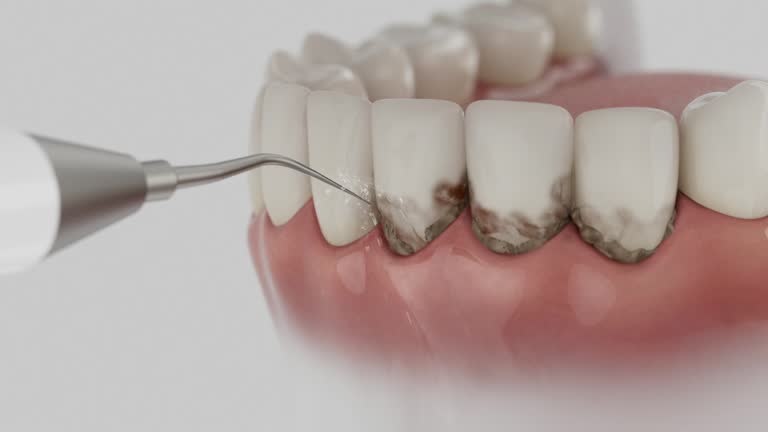 Reliable Dental contractor in Stevenson Ranch, CA by Dentist Open Now